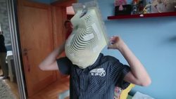 First treatment for Ashya, boy who had same therapy gives advice News Clip