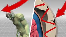 Football and concussions: changing the helmet could help prevent injuries on the field Instructional Video