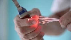 Optical fiber Stock Footage