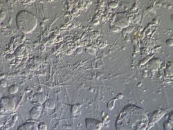 Semenal plasma - cells and Human sperm in semen, Interference contrast Stock Footage