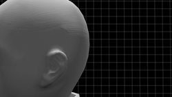 Auditory brainstem implant gives three-year-old Grayson the gift of hearing  Instructional Video