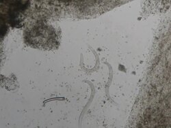 Parasite : Strongeroides stercolaris Stock Footage