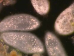 Paramecia moving around with cilia waving, Dark Field illumination Stock Footage