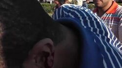 Fierce clashes in Alexandria; rival mass protests in the capital Instructional Video