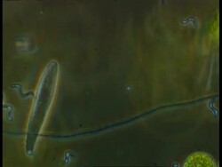 Unidentified freshwater organism (possibly a ciliate) Stock Footage