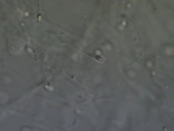 Human sperm swimming, Interference contrast Stock Footage