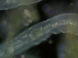 Planarian worm Stock Footage