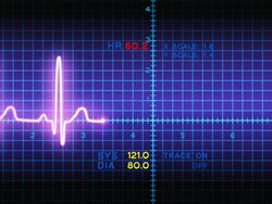 Ekg Animation Stock Footage