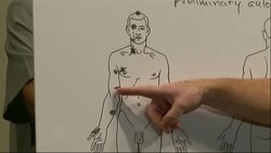 Missouri: Autopsia de Brown indica que recibio seis disparos News Clip