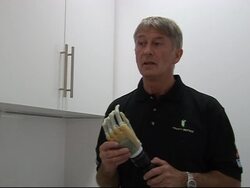 Bionic hands change the lives of amputees News Clip