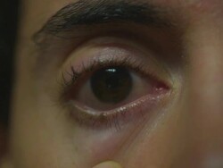 HD MONTAGE: One eyeball Stock Footage