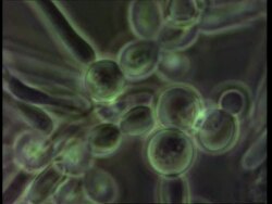 Candida albicans, live Thrush fungus, time lapse fungal hyphae growing Stock Footage