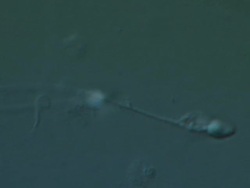 Single Human sperm swimming, big close up, Interference contrast Stock Footage