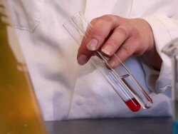 Closeup of a person holding two test-tubes. Stock Footage
