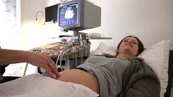 Baby Ultrasound Stock Footage