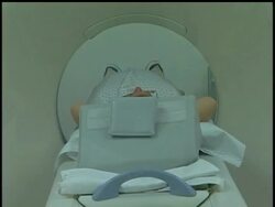 Improving news on the cancer front: Death rates are dropping faster than ever, thanks to new progress against colorectal cancer. News Clip