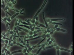 Candida albicans, live Thrush fungus, time lapse fungal hyphae growing Stock Footage