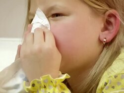 Little girl coughing and cleaning her nose. Stock Footage