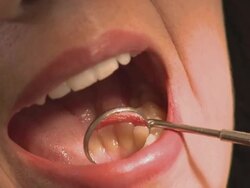 CU ZO Dentist examining woman's teeth with dental mirror during examination / Berlin, Germany Stock Footage