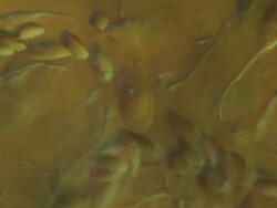 Capillaries of Toad tadpole tail.  Olympus BH-2 microscope Olympus S-Plan 20x objective with 5x photoeyepiece. Differential Interference Contrast. Shutter speed 1/1000 second. Horizontal field of view 340 micrometres. Stock Footage