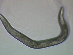 Videomicrography of rolling mutant Caenorhabditis elegans. Stock Footage