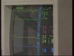 USA: WASHINGTON: INITIATIVES TO IMPROVE HEALTH CARE FOR MINORITIES News Clip