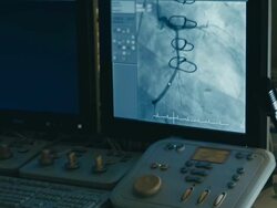 Surgery control panel. Blood vessels of human body on the screen Stock Footage