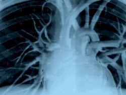 Live X-Ray Image of Human Torso Stock Footage