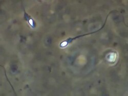 Single Human sperm swimming, close up, Phase contrast Stock Footage