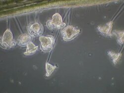 Vorticella protozoa feeding. Stock Footage