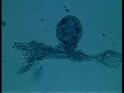 CU microscopic view of Amoeba, large food vacuole and prey Stock Footage