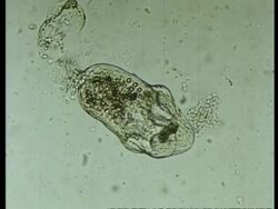 Microscopic view of Tapeworm, archive, CU Stock Footage