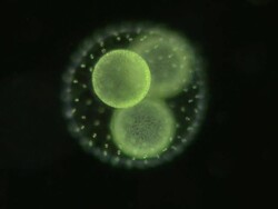 Volvox colony with daughter colonies; composed of hundreds of green algae cells each with 2 whip like flagellae and a red eye spot. Stock Footage