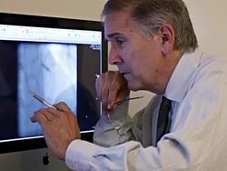 CU Cardiologist checking stent placement on patient heart scan at computer / Los Angeles, California, United States Stock Footage