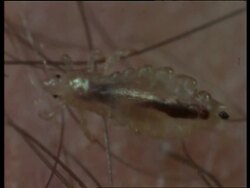 CU sequence of Head lice feeding, shows blood inside gut, United Kingdom; SEQUENCE OF CLIPS, SPECIAL TERMS APPLY Stock Footage