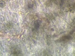 Phase Contrast view of Toad (Bufo bufo) tadpole tail capillary with leucocyte rolling. Olympus BH-2 microscope, Olympus S-Plan 10x phase objective, NFK 5x photoeyepiece. Stock Footage