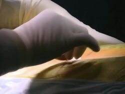  CU Surgeon holding tool and measuring / Cagliari, Sardinia, Italy Stock Footage