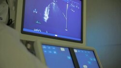 EKG monitoring patient heart rate and blood oxygen at hospital Stock Footage