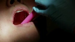 Healthcare Dental Cleaning Service at Clinic Stock Footage