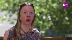 My Rare Facial Deformity Nearly Ruined My Life | BORN DIFFERENT Instructional Video