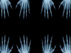 BONE HANDS Stock Footage