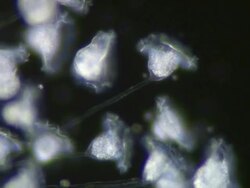 Dark Field view of Vorticella filter feeding on bacteria. Stock Footage