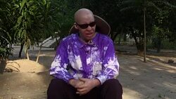 VOICED : Los albinos buscan seguridad en la isla tanzana de Ukerewe News Clip