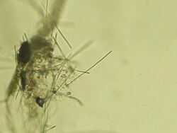 Microorganisms Stock Footage