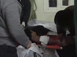 Hospital victims of snipers and shelling Stock Footage