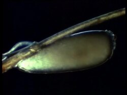 CU microscopic view of newly laid head louse eggs, United Kingdom Stock Footage