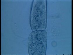 CU microscopic view of two Paramecium conjugating Stock Footage