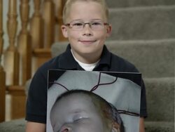 Child holding picture of himself as an infant with a birth defect Stock Footage