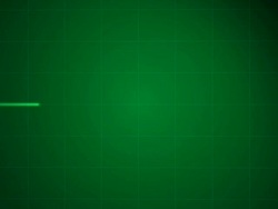 flatline EKG ECG taking puls v5.0 Stock Footage