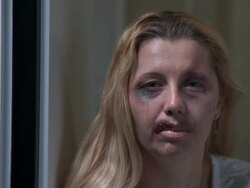 HD DOLLY: Abused Wife Begging For Help Stock Footage